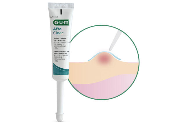 GUM Afta Clear Gel 10 ml-3