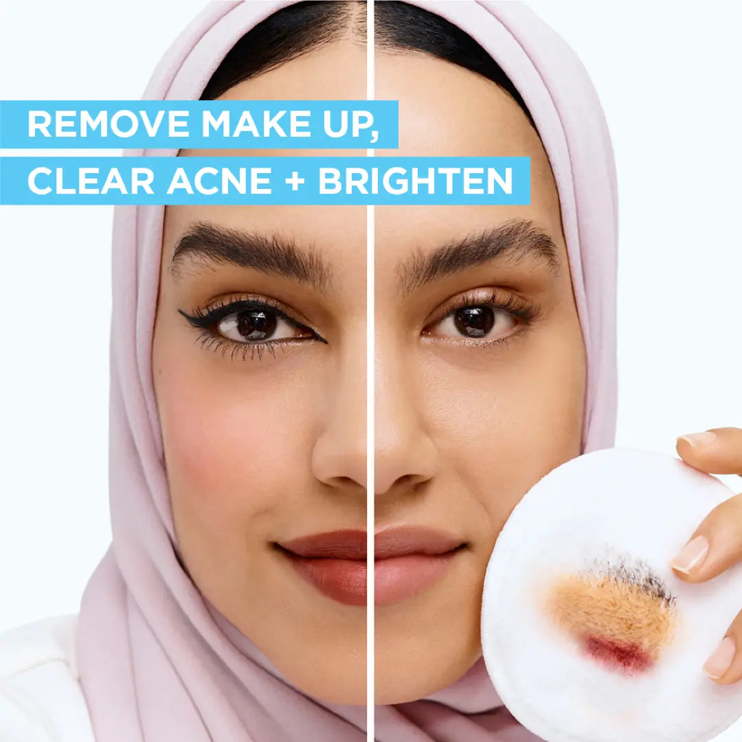 Garnier SkinActive Micellar Cleansing Water With Salicylic Acid 400ml-6