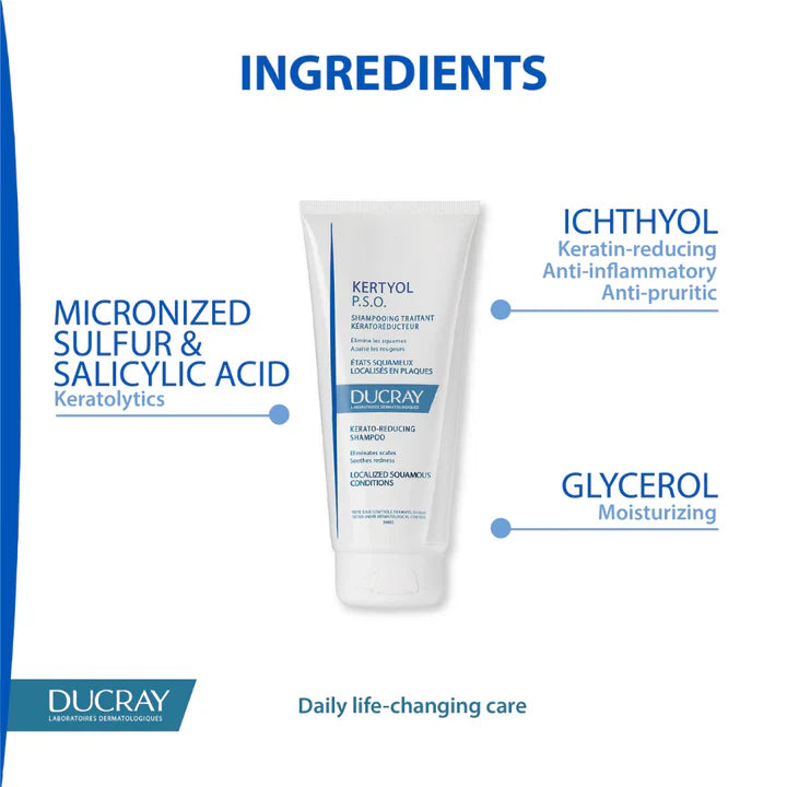 Ducray Kertyol P.S.O. Treatment Shampoo 200ml For Psoriasis-Prone Scalp