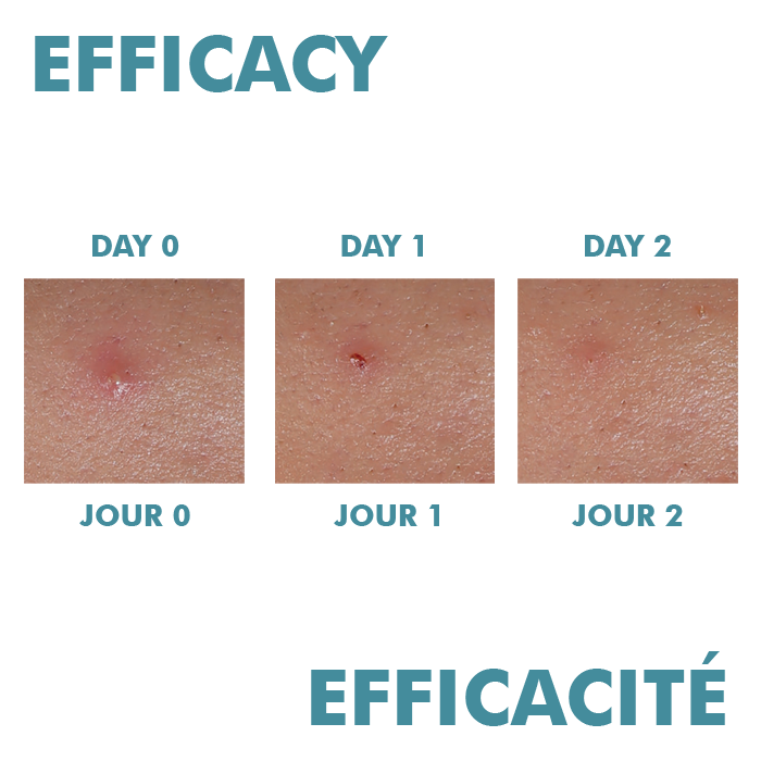 Avene Cleanance Comedomed Peeling Intensive Anti-Acne Face Cream 40ml-4