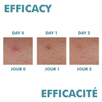 Avene Cleanance Comedomed Peeling Intensive Anti-Acne Face Cream 40ml-4