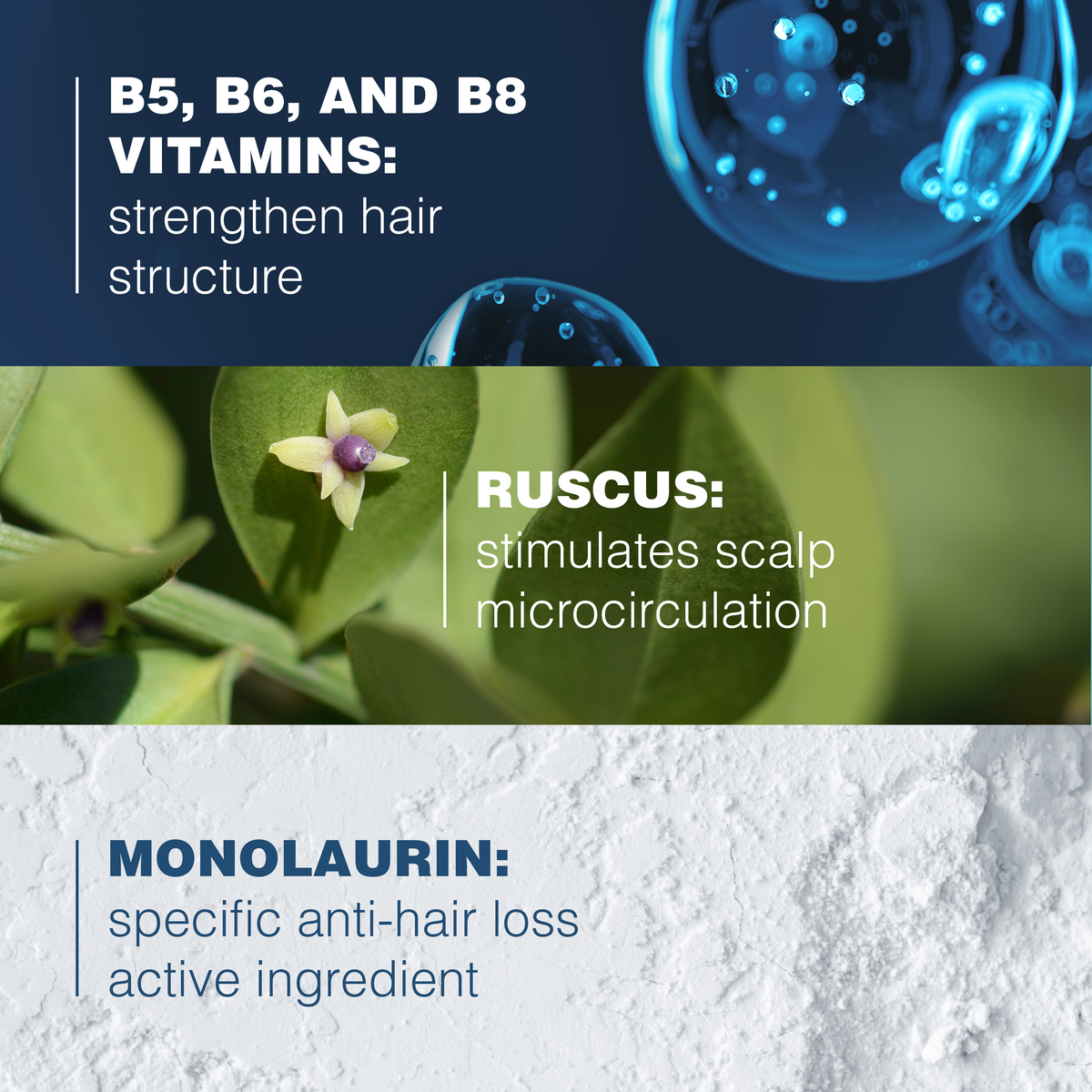 Ducray Anaphase+ Anti-Hair Loss Shampoo 200ml for Thinning Hair-8