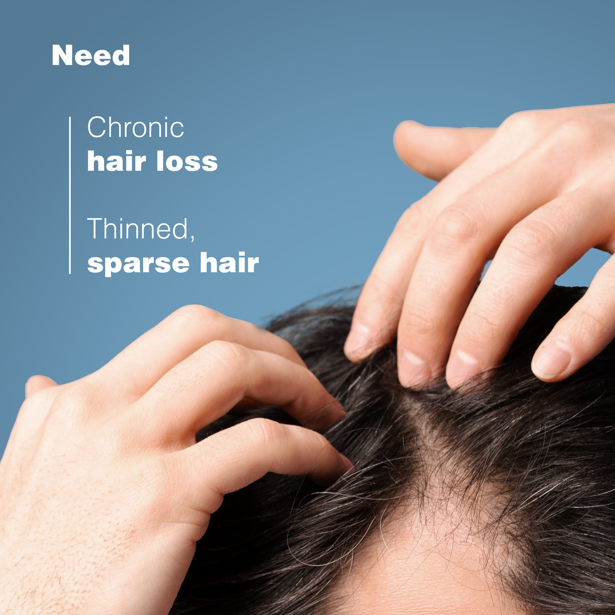 Ducray Anaphase+ Anti-Hair Loss Shampoo 200ml for Thinning Hair-10